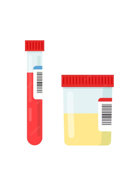Creatinine Clearance